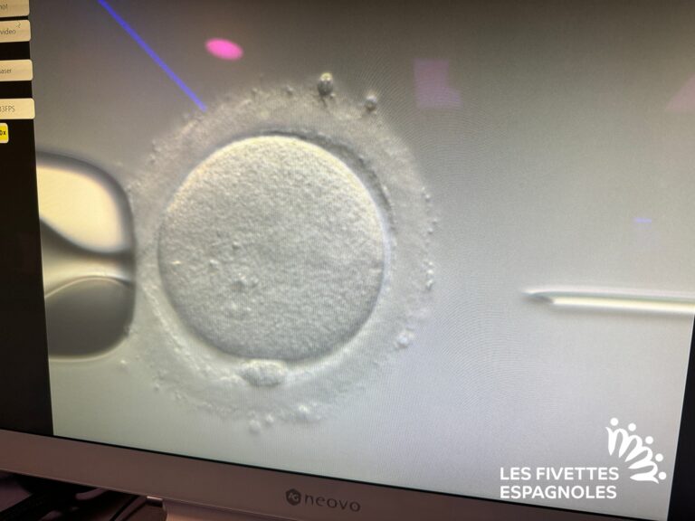 Clinique PMA Don ovocytes Tambre Madrid (34)