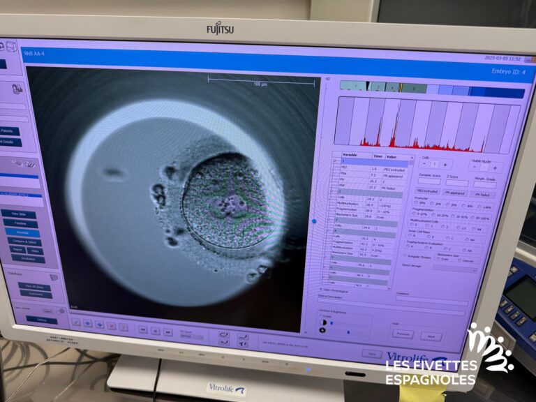 clinique fiv don ovocytes girexx barcelone 2025 (7)