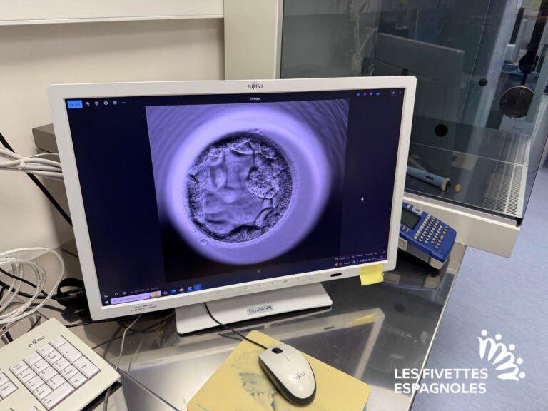 clinique fiv don ovocytes girexx barcelone 2025 (9)